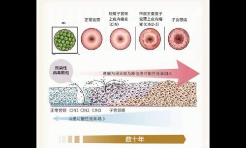 扁平疣用醋精涂了后果-权威扁平疣用药后变大怎么回事平台,分享专业扁平疣用药能治好吗知识_扁平疣用药醋酸网